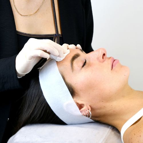 Chemical Peels