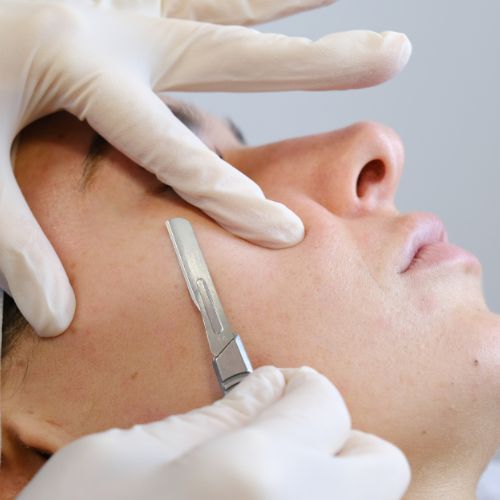 Dermaplaning